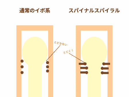 スパイナルスパイラルの丸イボ