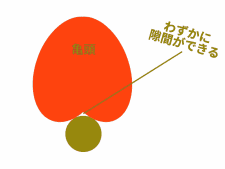 丸イボ突起は隙間ができる