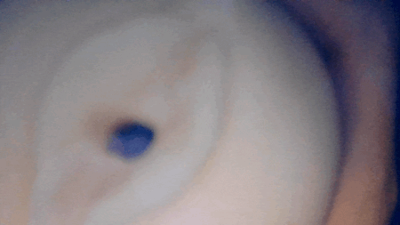 膣細胞の内部カメラ