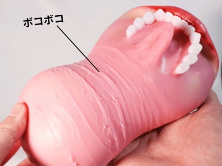 極真の口 宮下玲奈は口蓋がボコボコ
