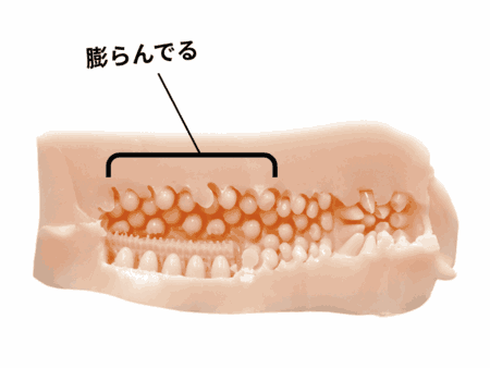 粒々Wレールスクイーズは後半が大口径
