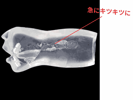 真実の口 レントゲンは喉奥がキツキツ
