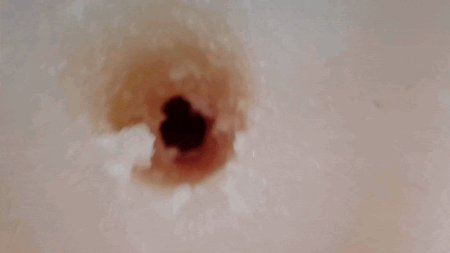 艶めき名器のアナル穴の内部カメラ