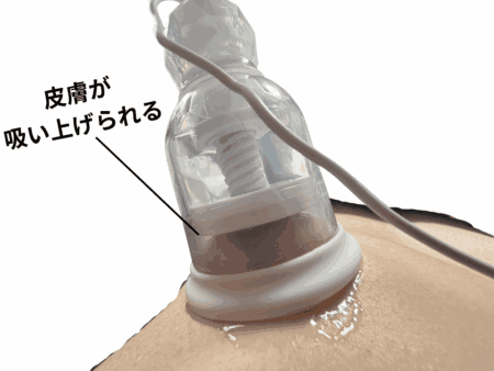 ニップルドームRは吸引力がつよい